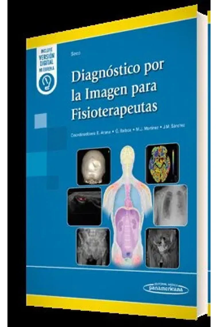 DIAGNOSTICO POR LA IMAGEN PARA FISIOTERAPEUTAS