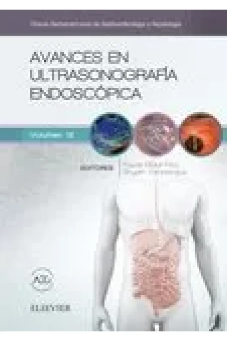 Avances en ultrasonografía endoscópica