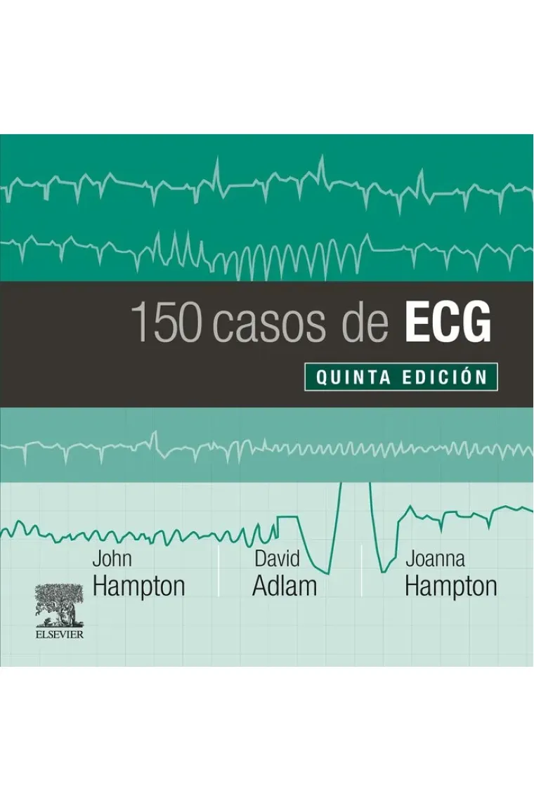 150 casos de ECG (5ª ed.)