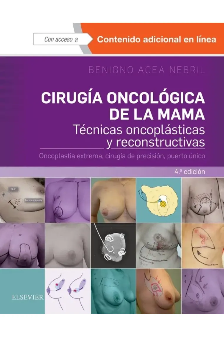 Cirugía oncológica de la mama (4ª ed.)