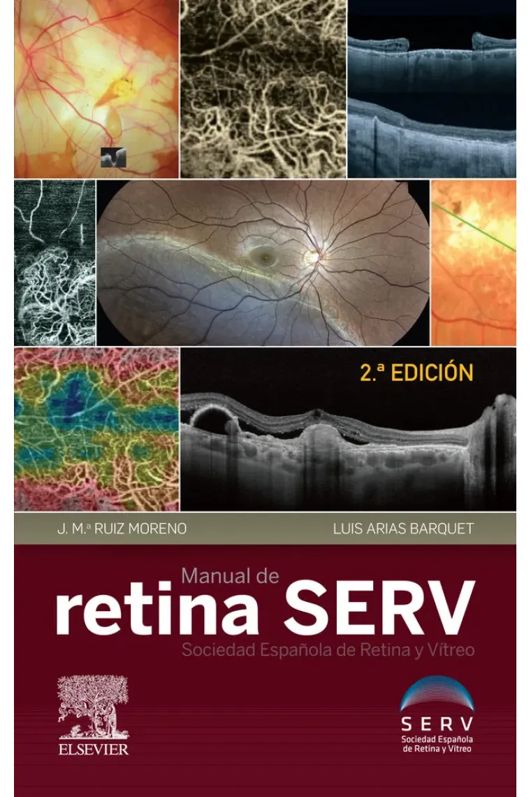 Manual de retina SERV (2ª ed.)